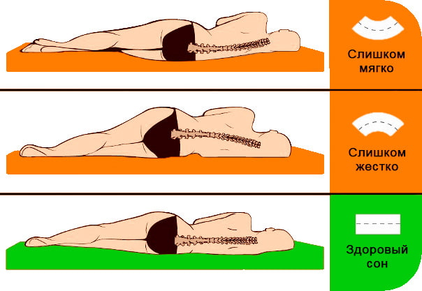 Ortopéd matracok merevsége